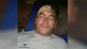 Motochorros balean a un delivery en la cabeza