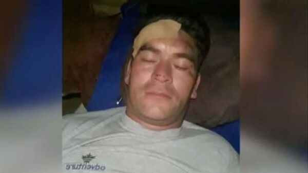 Motochorros balean a un delivery en la cabeza
