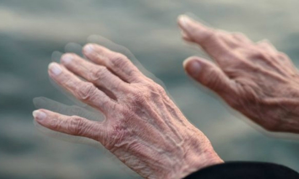 Parkinson: Signos motores de alerta temprana - OviedoPress