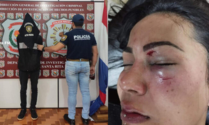 Detienen a joven que golpeó brutalmente a su novia en Santa Rita - OviedoPress