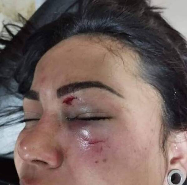 Preso por garrotear a su pareja hasta desfigurarla