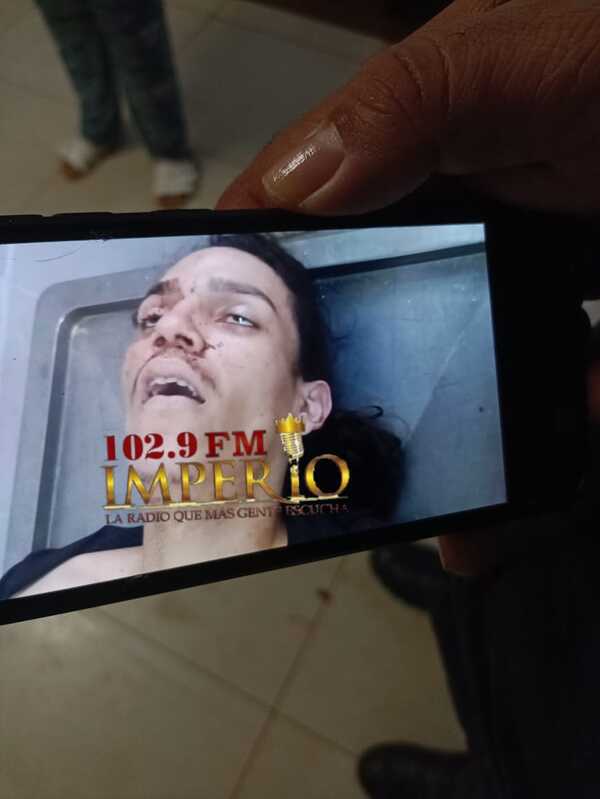 Identifican a joven que supuestamente intentó asesinar a dueño de un taller - Radio Imperio
