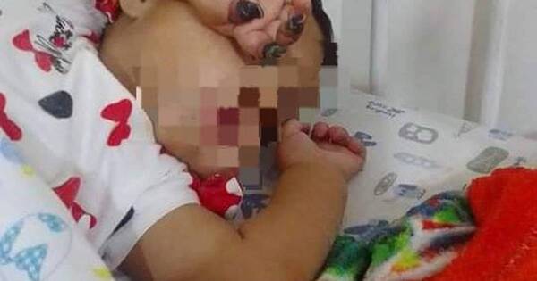 La Nación / Todos por Melody: beba de 9 meses necesita de varias cirugías y apelan a la solidaridad