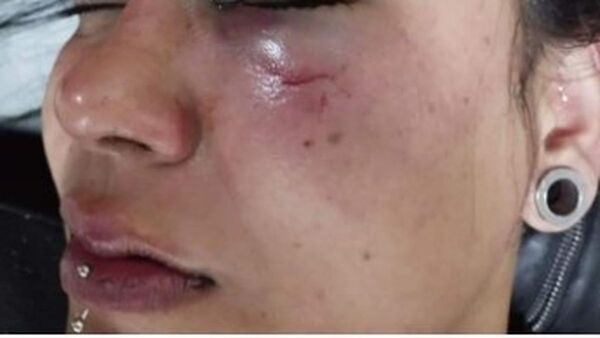 Apresan a joven que desfiguró a su pareja