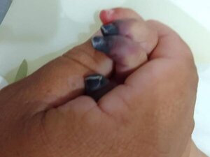 Amputarán 4 deditos a bebé tras presunta negligencia médica