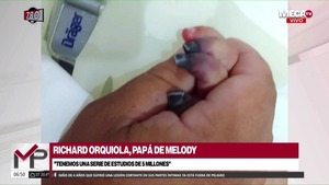 El desesperado relato del padre de la pequeña que perderá cuatro deditos: "Me duele el corazón" - Megacadena — Últimas Noticias de Paraguay
