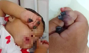 Pediatra niega supuesta negligencia en el caso de la pequeña Melody - OviedoPress