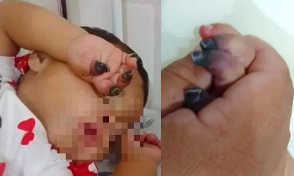 Pediatra niega supuesta negligencia en el caso de la pequeña Melody - OviedoPress