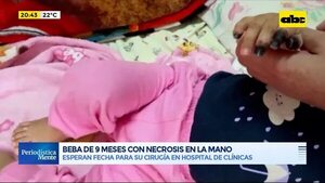 Video: Beba de 9 meses con necrosis en la mano  - Periodísticamente - ABC Color