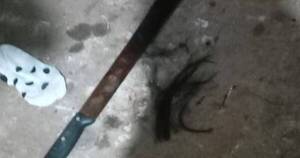 La Nación / Un hombre hirió en la cabeza con un machete a su pareja en San Lorenzo