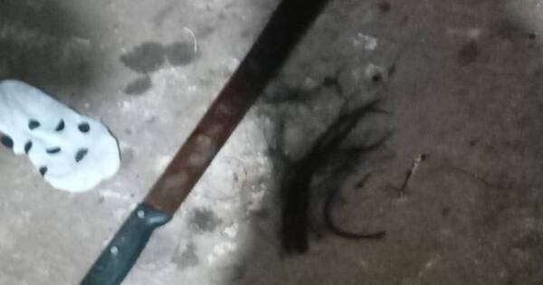 La Nación / Un hombre hirió en la cabeza con un machete a su pareja en San Lorenzo