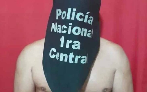 ¡Macabro! Hombre provoca graves heridas a su pareja con un machete en San Lorenzo – Prensa 5