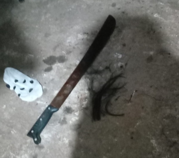 Hombre habría atacado a machetazos a su concubina - trece