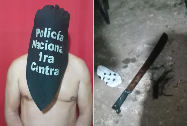 Intento de feminicidio en San Lorenzo: Hirió a su pareja con un machete porque le reclamó una deuda de G. 300 mil - Megacadena — Últimas Noticias de Paraguay