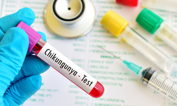 Con 1.296 casos de chikungunya Coronel Oviedo se ubica como el distrito con mayor casos - OviedoPress