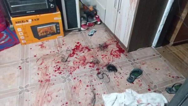 Intento de feminicidio: víctima perdió mano derecha y su concubino fue imputado - Policiales - ABC Color