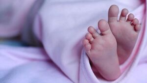 Ultiman estudios para cirugía de beba con necrosis en los dedos