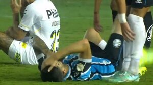 Versus / Villasanti es baja en Grêmio luego de sufrir "múltiples fracturas" en la cara