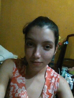 Mujer hallada en el pozo vivía torturada por su pareja a quien imputan por feminicidio - ABC en el Este - ABC Color