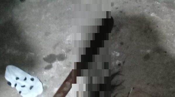 Imputan por intento de feminicidio a hombre que agredió a su pareja en San Lorenzo - Noticiero Paraguay