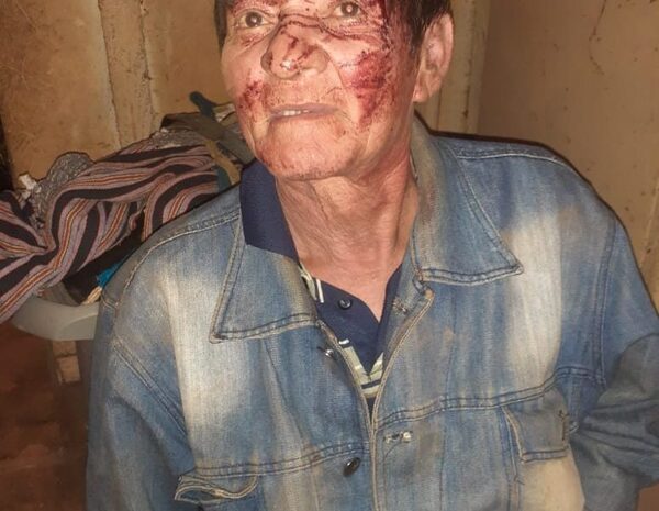 Asaltantes vigilaban a sus víctimas desde un matorral – Diario TNPRESS
