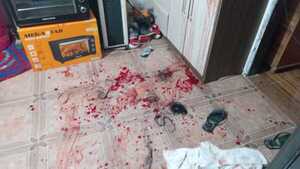 Una mujer fue atacada por su pareja con machete y cuchillo - San Lorenzo Hoy