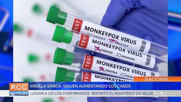Viruela símica: siguen aumentando los casos y ya llegan a 125 los confirmados