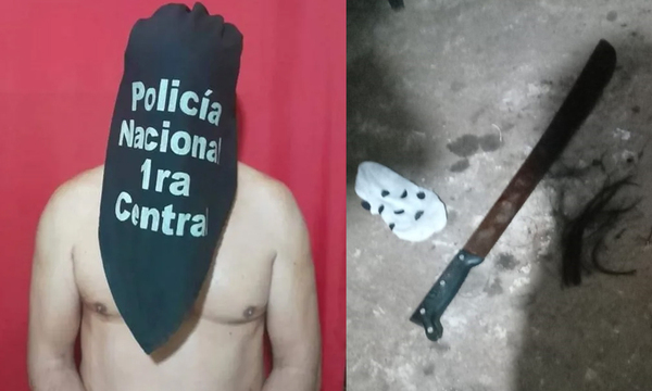Mujer atacada a machetazo por su pareja en San Lorenzo perdió una mano - OviedoPress
