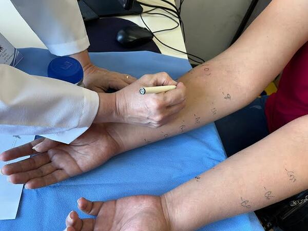 Diario HOY | Clínicas ofrece pruebas de alergia: desde polen, ácaros hasta cucaracha