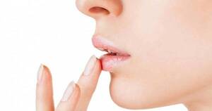 La Nación / Interesante guía básica para cuidar los labios secos y agrietados