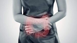 Síndrome de colon irritable, un transtorno incómodo - Estilo de vida - ABC Color