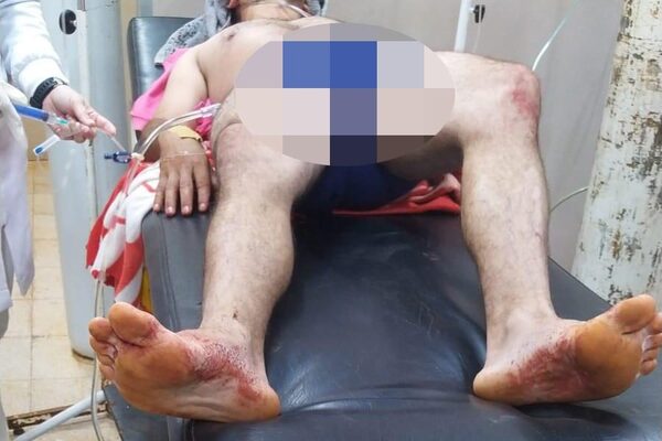 Escuchó ruido en el patio de su casa, salió a verificar y recibió un balazo – Diario TNPRESS