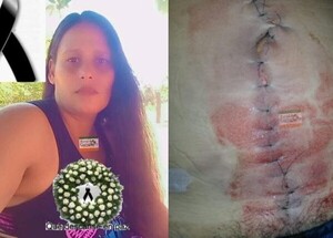 MUERTE DE MUJER TRAS CIRUGÍA EN EL HOSPITAL DE CURUGUATY CAMINO A LA IMPUNIDAD - La Voz del Norte