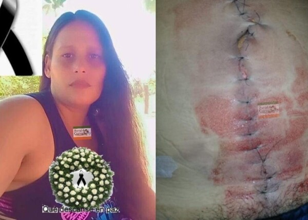MUERTE DE MUJER TRAS CIRUGÍA EN EL HOSPITAL DE CURUGUATY CAMINO A LA IMPUNIDAD - La Voz del Norte