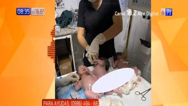 ¡Triple bendición! Esperaba mellizos y tuvo trillizos - Noticias Paraguay