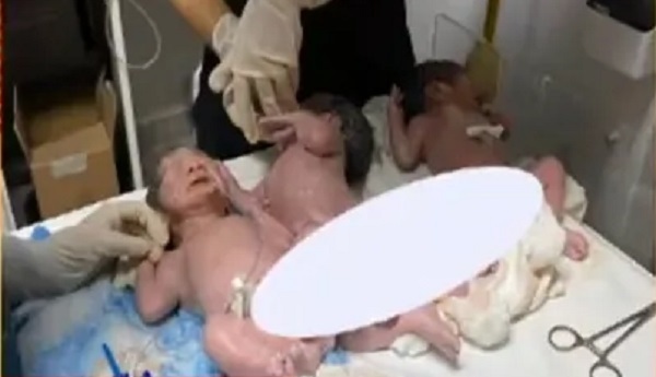 ¡Triple bendición! Esperaba mellizos y tuvo trillizos - Noticiero Paraguay