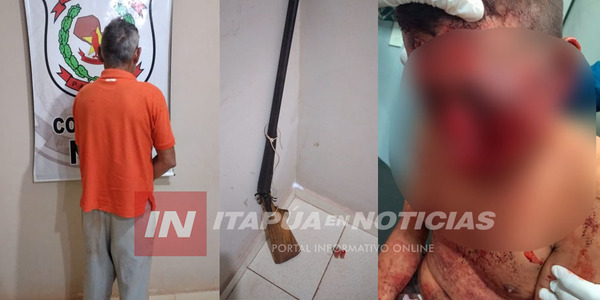 NO QUISO COMPRAR VINO Y SU TÍO LE DISPARÓ UN ESPOPETAZO EN EL ROSTRO - Itapúa Noticias