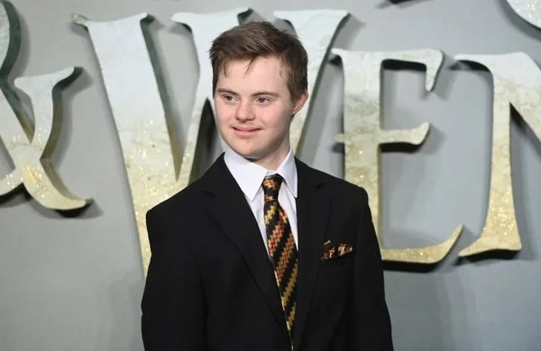 Disney produce film y el protagonista es un niño síndrome de Down