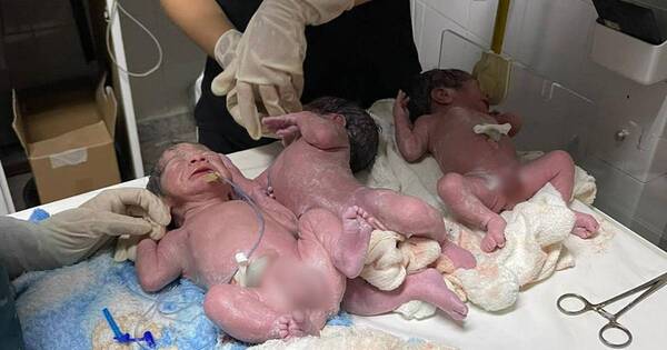 La Nación / Se agrandó la familia en Altos: mamá esperaba mellizos, pero sorpresivamente vinieron tres