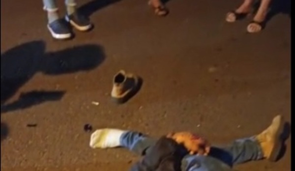 Accidente de tránsito: Menor de 17 años se encuentra en grave estado - Radio Imperio