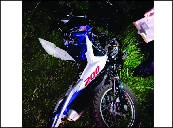 San Juan Bautista: accidente de tránsito cobra la vida de un joven