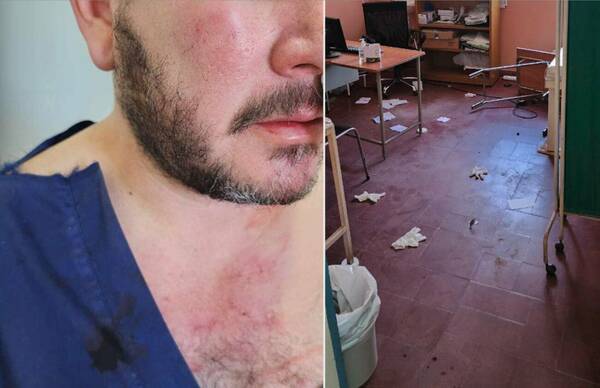 Tonguearon todo mal a un médico en hospital de Limpio