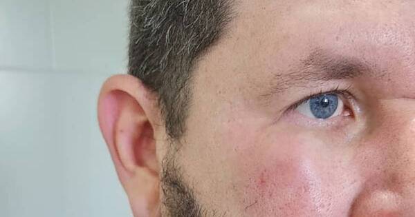 La Nación / Golpearon a un médico del hospital de Limpio y Sinamed se pronunció al respecto