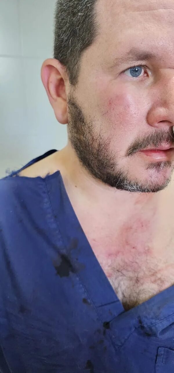 Hospital de Limpio: doctor fue agredido por paciente y está internado - Nacionales - ABC Color