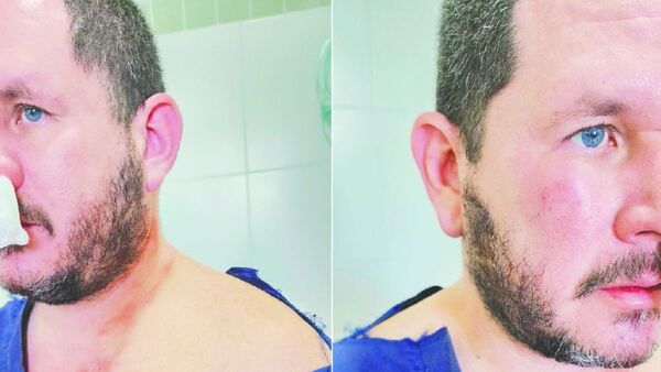 Médico recibió brutal golpiza de un familiar de paciente