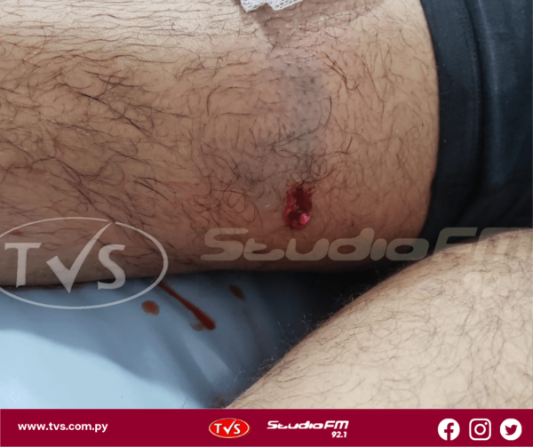 DESCONOCIDOS BALEAN A UN HOMBRE EN SAN PEDRO DEL PARANÁ