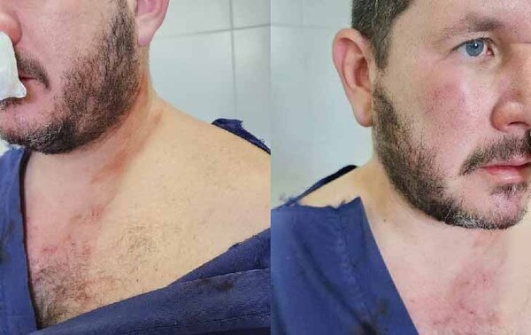 Médico agredido en Hospital de Limpio será sometido a cirugía tras brutal golpiza – Prensa 5