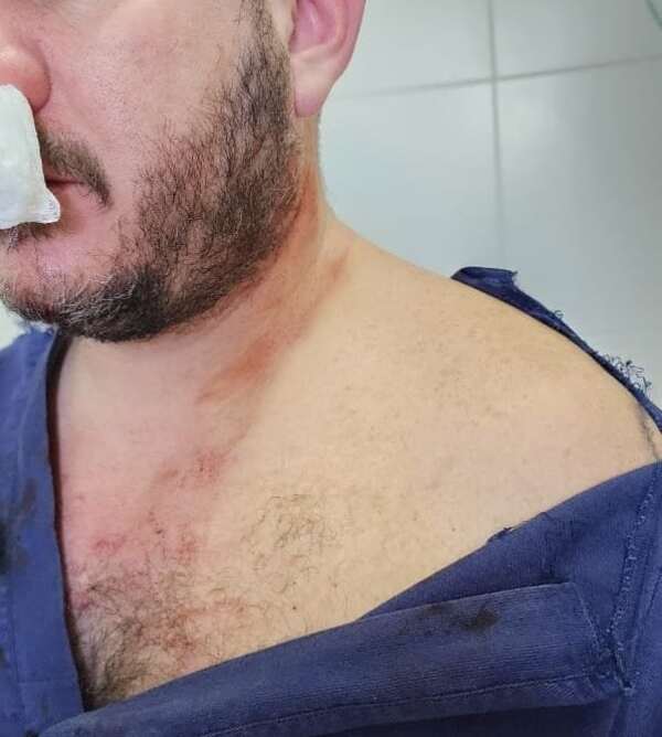 Médico agredido en Hospital de Limpio será sometido a cirugía tras brutal golpiza