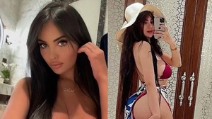 Diario HOY | Modelo se operó la cola para tenerla más grande de Kim Kardashian y no puede caminar