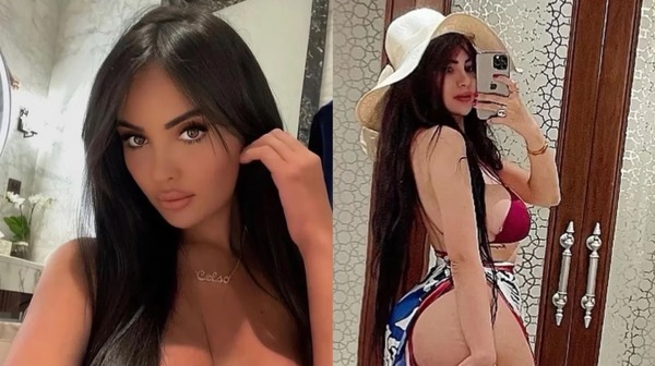 Diario HOY | Modelo se operó la cola para tenerla más grande de Kim Kardashian y no puede caminar
